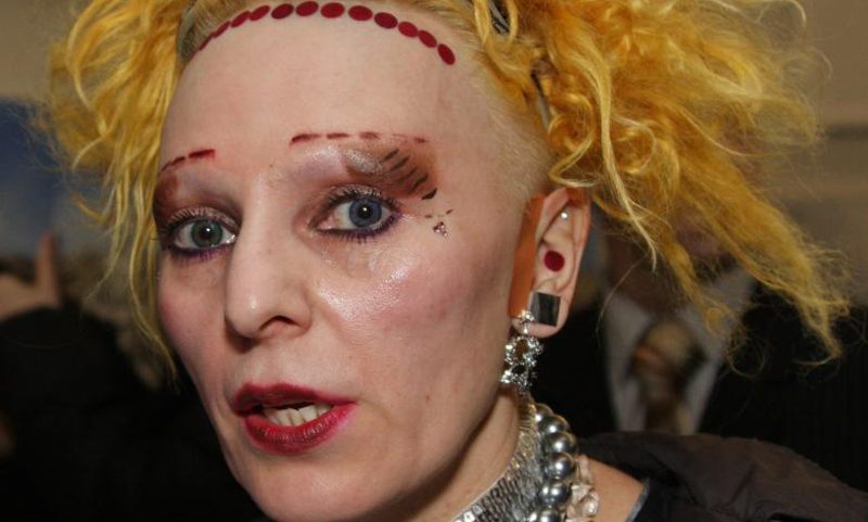 Она потеряла своё лицо: 57-летняя Жанна Агузарова превратилась в куклу